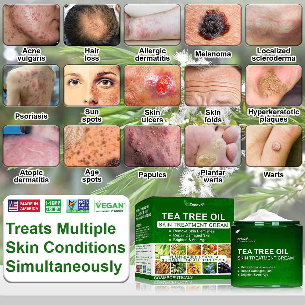 🔥𝐳𝐯𝐨𝐞𝐯𝐨® 𝐓𝐞𝐚 𝐓𝐫𝐞𝐞 𝐎𝐢𝐥 𝐒𝐤𝐢𝐧 𝐓𝐫𝐞𝐚𝐭𝐦𝐞𝐧𝐭 𝐂𝐫𝐞𝐚𝐦✅𝐅𝐃𝐀-𝐀𝐏𝐏𝐑𝐎𝐕𝐄𝐃 – Removes Skin Blemishes, Repairs Damaged Skin, Brightens & Anti-Ageing Care