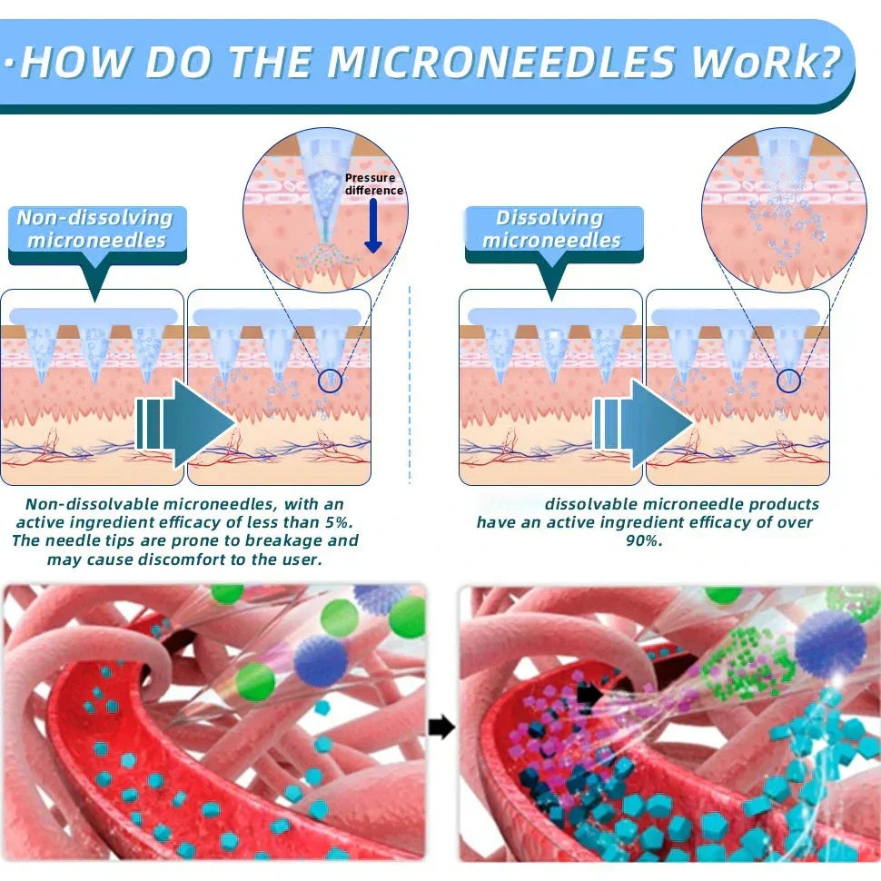 【NATRAVOR® Official Store👨🏻‍⚕️】 𝐍𝐈𝐃𝐃𝐊-𝐓𝐢𝐫𝐳𝐞𝐩𝐚ti𝐝𝐞 𝐍a𝐧𝐨 𝐌𝐢𝐜𝐫𝐨𝐧e𝐞𝐝𝐥𝐞 𝐏a𝐭𝐜𝐡 🇺🇸（Zero Pain, 24/7 Release | Lose 20lbs FAST | 90% Sugar Drop | ）
