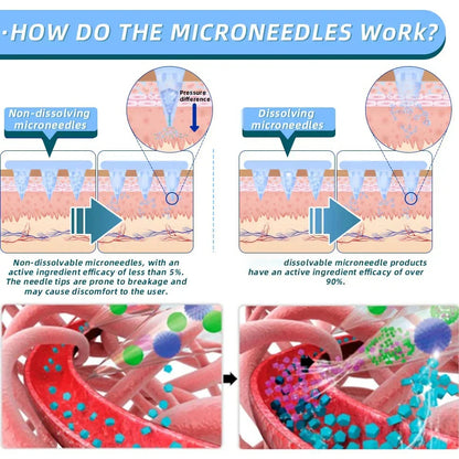 【NATRAVOR® Official Store👨🏻‍⚕️】 𝐍𝐈𝐃𝐃𝐊-𝐓𝐢𝐫𝐳𝐞𝐩𝐚ti𝐝𝐞 𝐍a𝐧𝐨 𝐌𝐢𝐜𝐫𝐨𝐧e𝐞𝐝𝐥𝐞 𝐏a𝐭𝐜𝐡 🇺🇸（Zero Pain, 24/7 Release | Lose 20lbs FAST | 90% Sugar Drop | ）